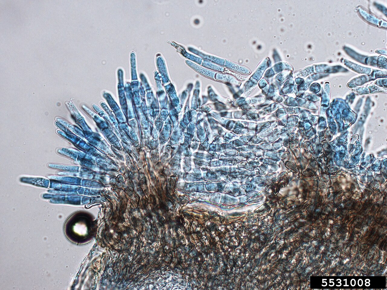 Microscopic view of scale insect