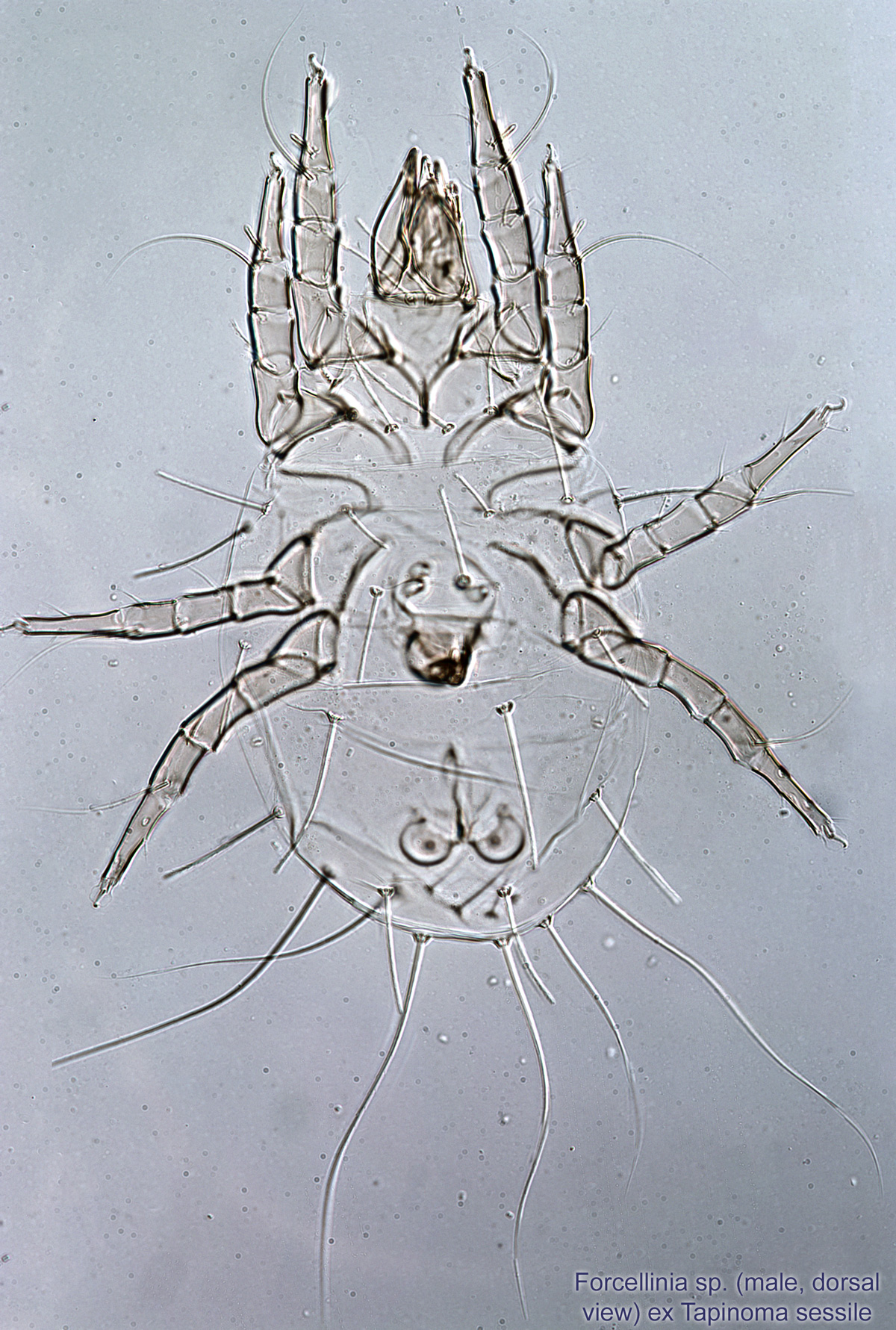 Microscopic view of ljeskova grinja mite