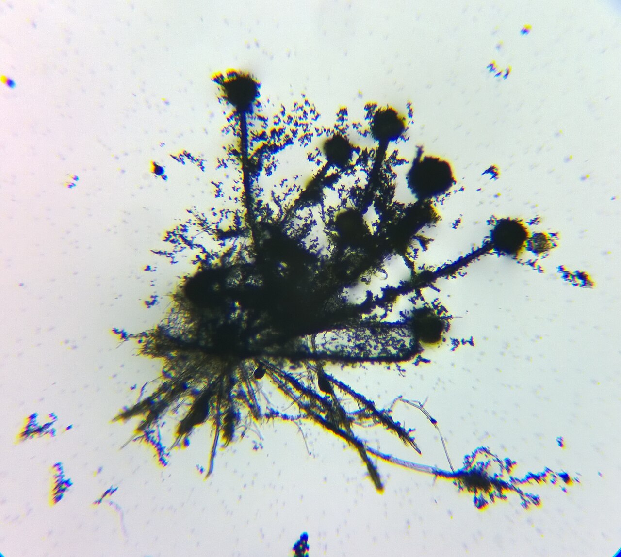 Microscopic Aspergillus mold colony