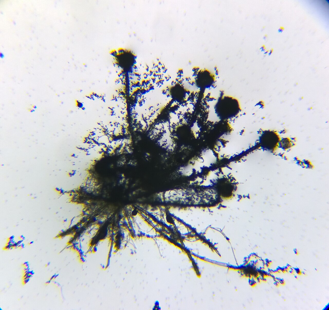 Microscopic Aspergillus mold