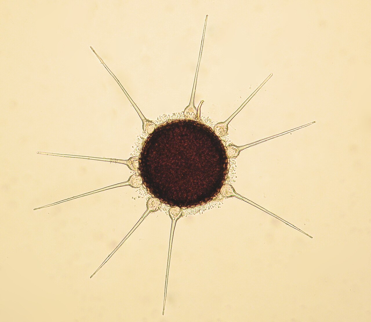 Kleistotecij pepelnice Phyllactinia guttata na listu lijeske pod povećanjem
