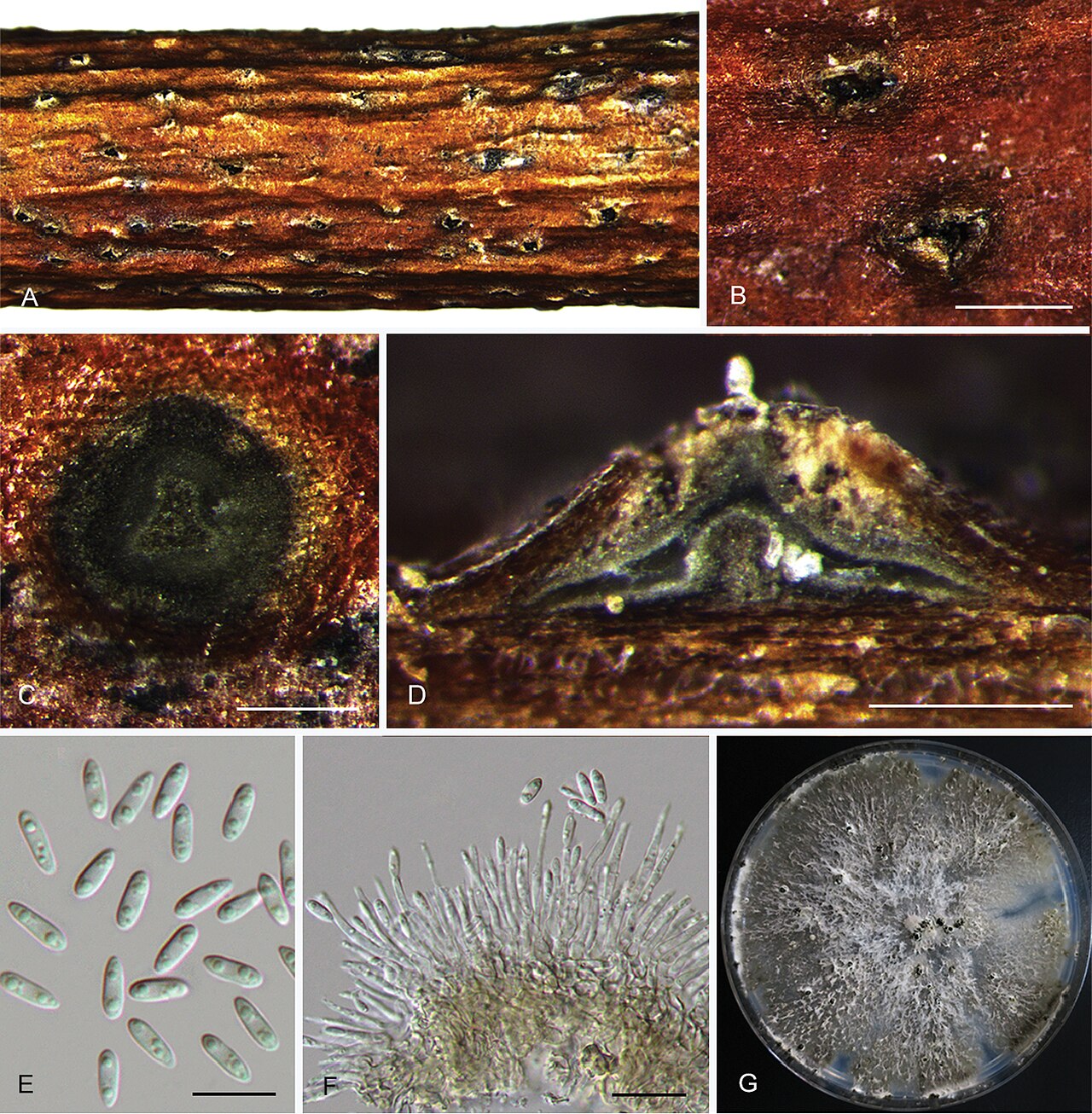 Diaporthe eres (anamorf Phomopsis) — mikroskopski prikaz plodišta i spora gljive iz kompleksa raka grana