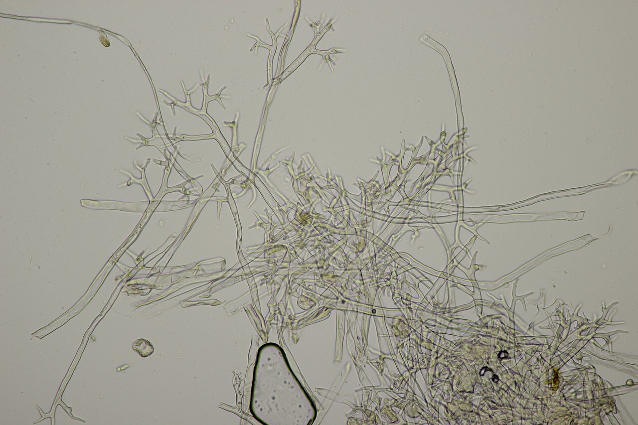 Fungal hyphae under microscope