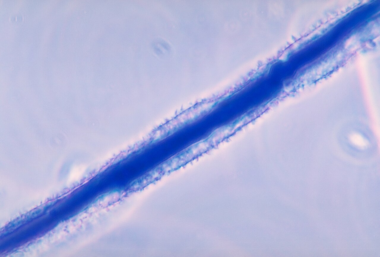 Plijesan roda Aspergillus flavus, uzrocnik aflatoksina koji prijeti slabo osusenom plodu