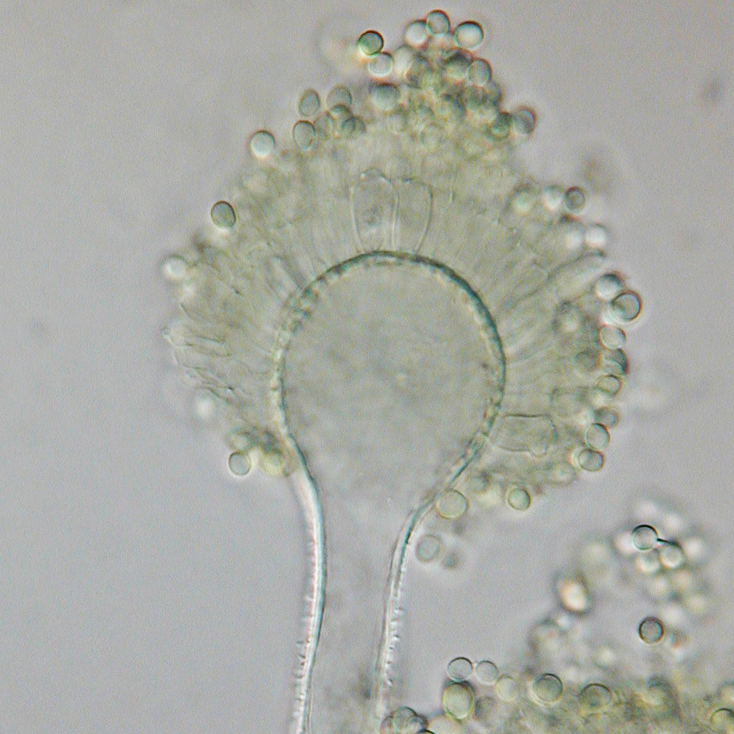 Konidiofor plijesni Aspergillus flavus pod mikroskopom, uzročnik aflatoksina pri lošem sušenju